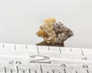 kidney stones