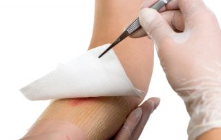 what is a buruli ulcer and what are the symptoms of a buruli ulcer