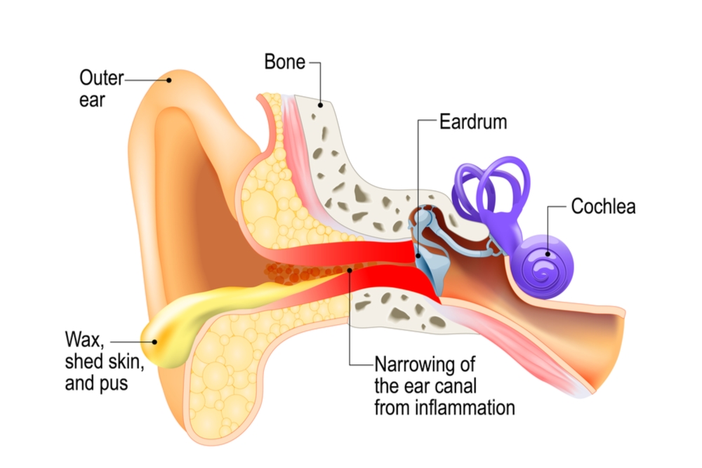 10 Common Reasons Your Ears Feel Clogged - GoodRx