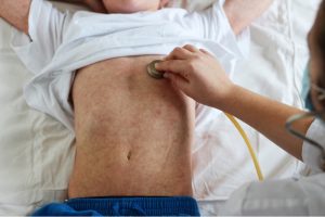 complications of measles