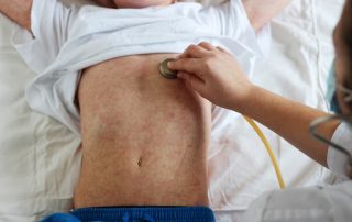complications of measles